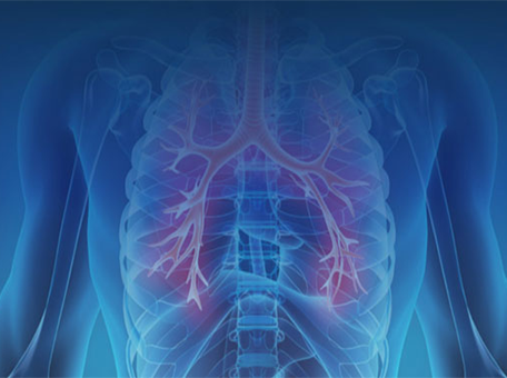 Nettside for pasienter med lungekreft